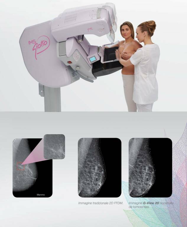 mammografo nuovo Gemelli