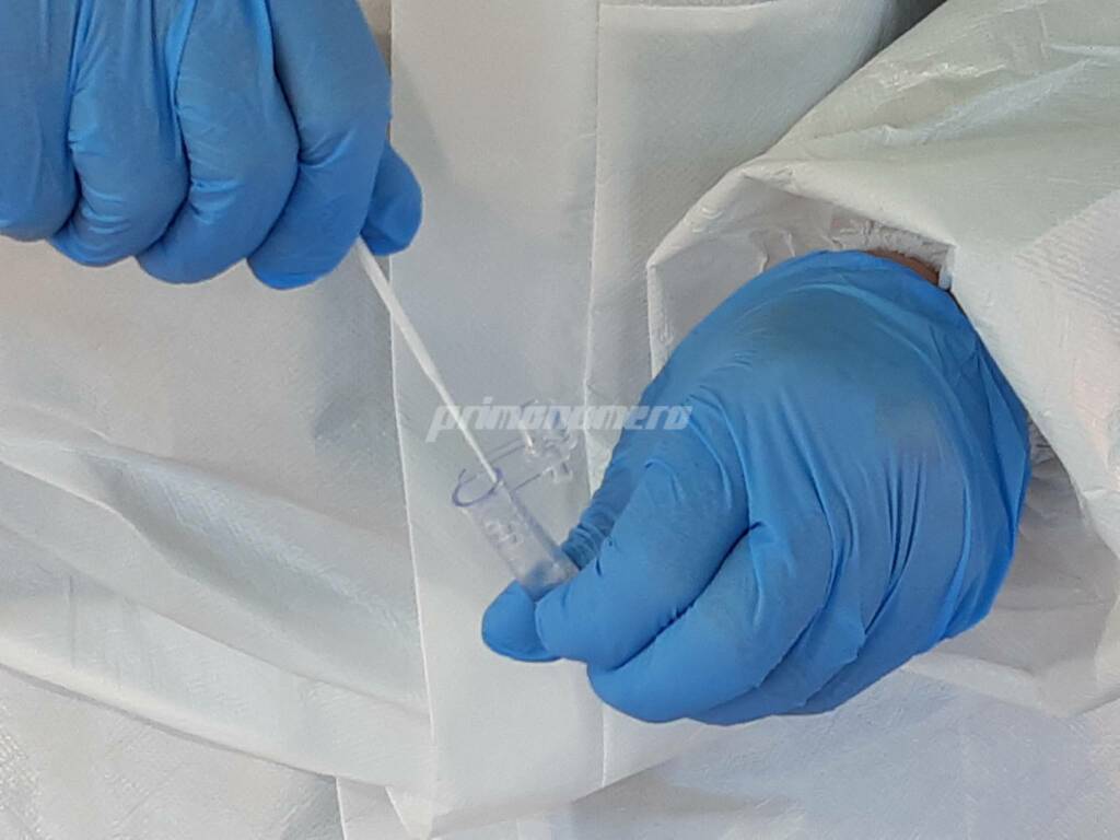 Screening tamponi rapidi antigenici covid Misericordia Termoli